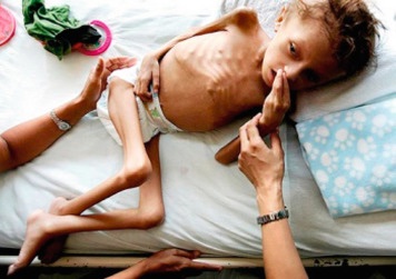 loveshack_baby's tweet photo. @RealFactsEitan @InsiderWorld_1 The child in the above picture is also FUCKING DEAD. https://t.co/pD1sbxvlOZ