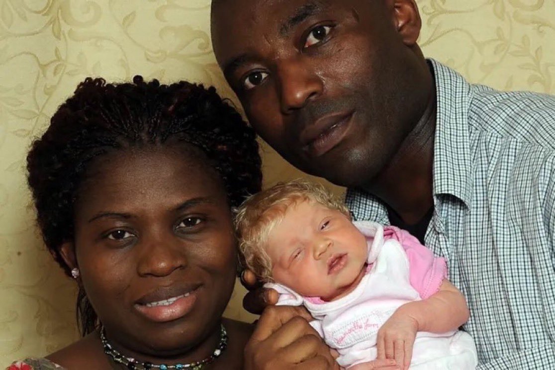 In the year 2010, a black Nigerian couple, Ben and Angela Ihegboro, living in the U.K. gave birth to a white, blonde, blue-eyed baby that they call the 'miracle baby.' 😂