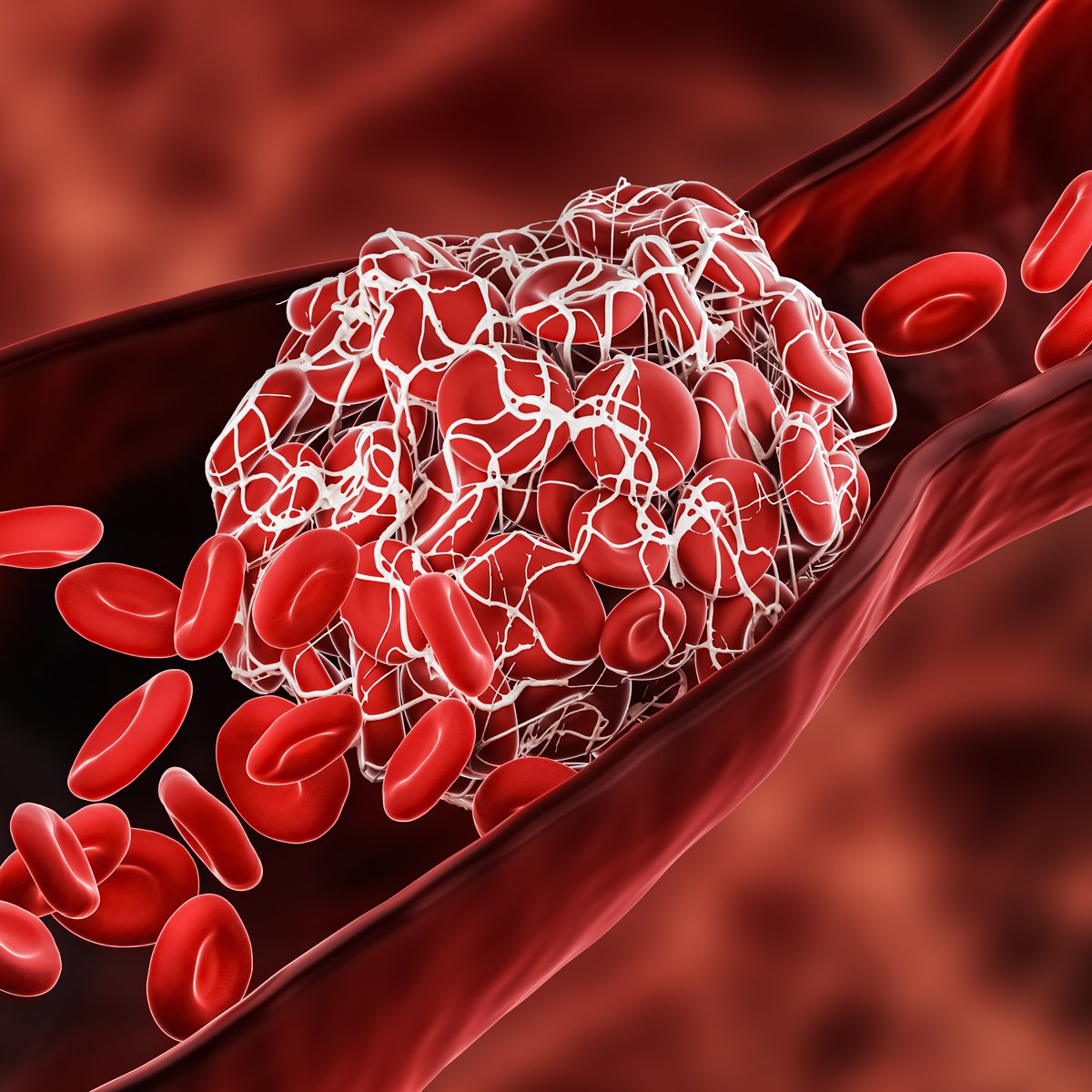 Research led by a professor at @UCSanta Cruz has discovered a secondary population of platelets with unique molecular properties that emerge with aging, making them potential targets for more effective treatments for blood clotting diseases. 

aau.edu/research-schol…