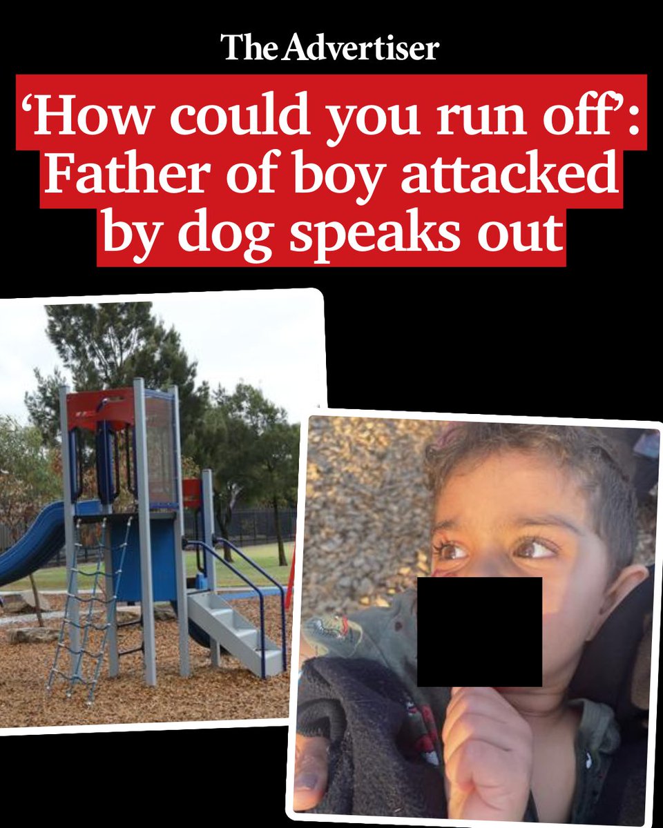 The father of a three-year-old boy bitten on the face by an unrestrained dog at a Pennington playground has urged the owner to come forward. (Warning - Graphic) Find out more: bit.ly/3V4dvAr #TheAdvertiser