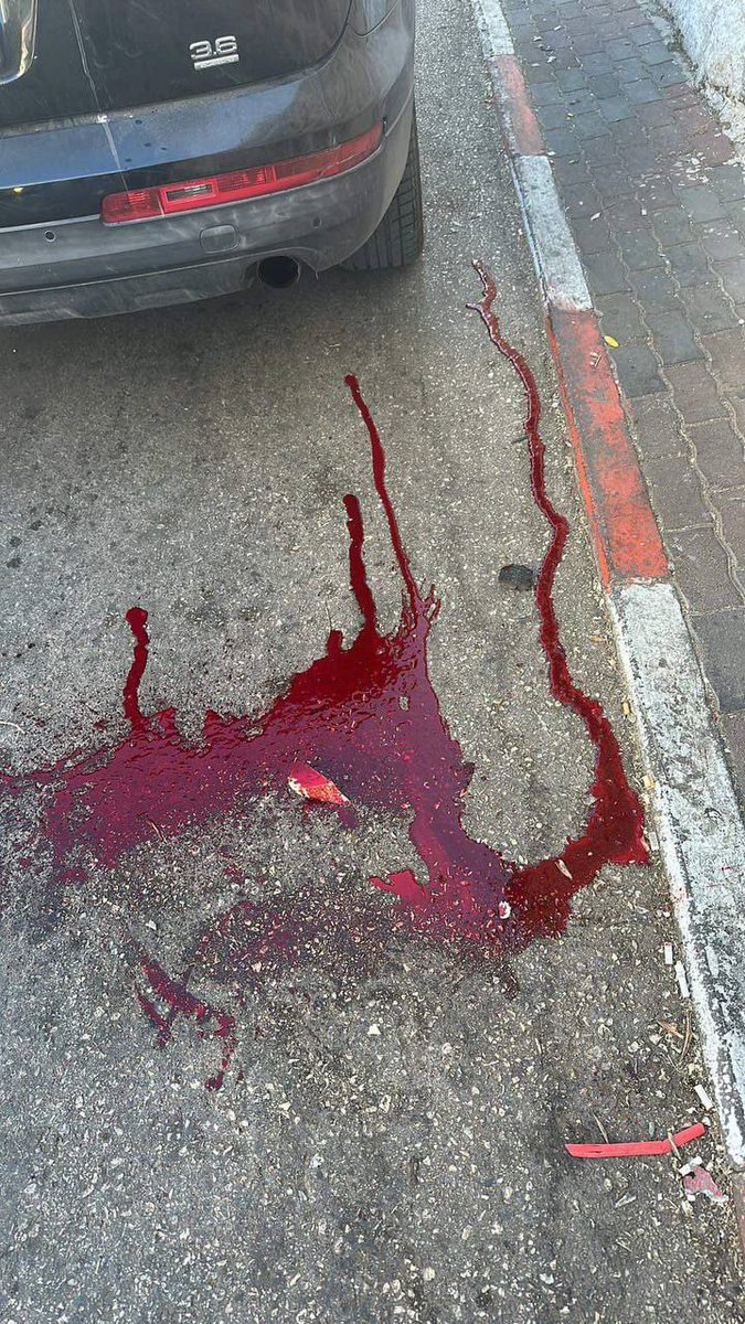 Seorang pemuda cedera terkena peluru zionis semasa menyerbu bandar Al-Bireh