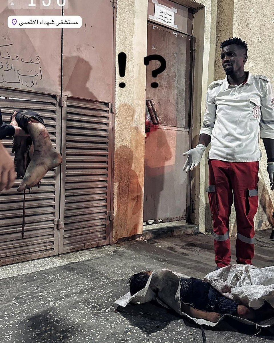 Las escenas de terror diarias de Gaza, los niños palestinos son despedazados y llevados por trozos a los hospitales ante las miradas incrédulas de los enfermeros que ven el infierno en primera persona.

Esto ocurrió esta noche, en el hospital Al-Aqsa, tras el bombardeo del campo