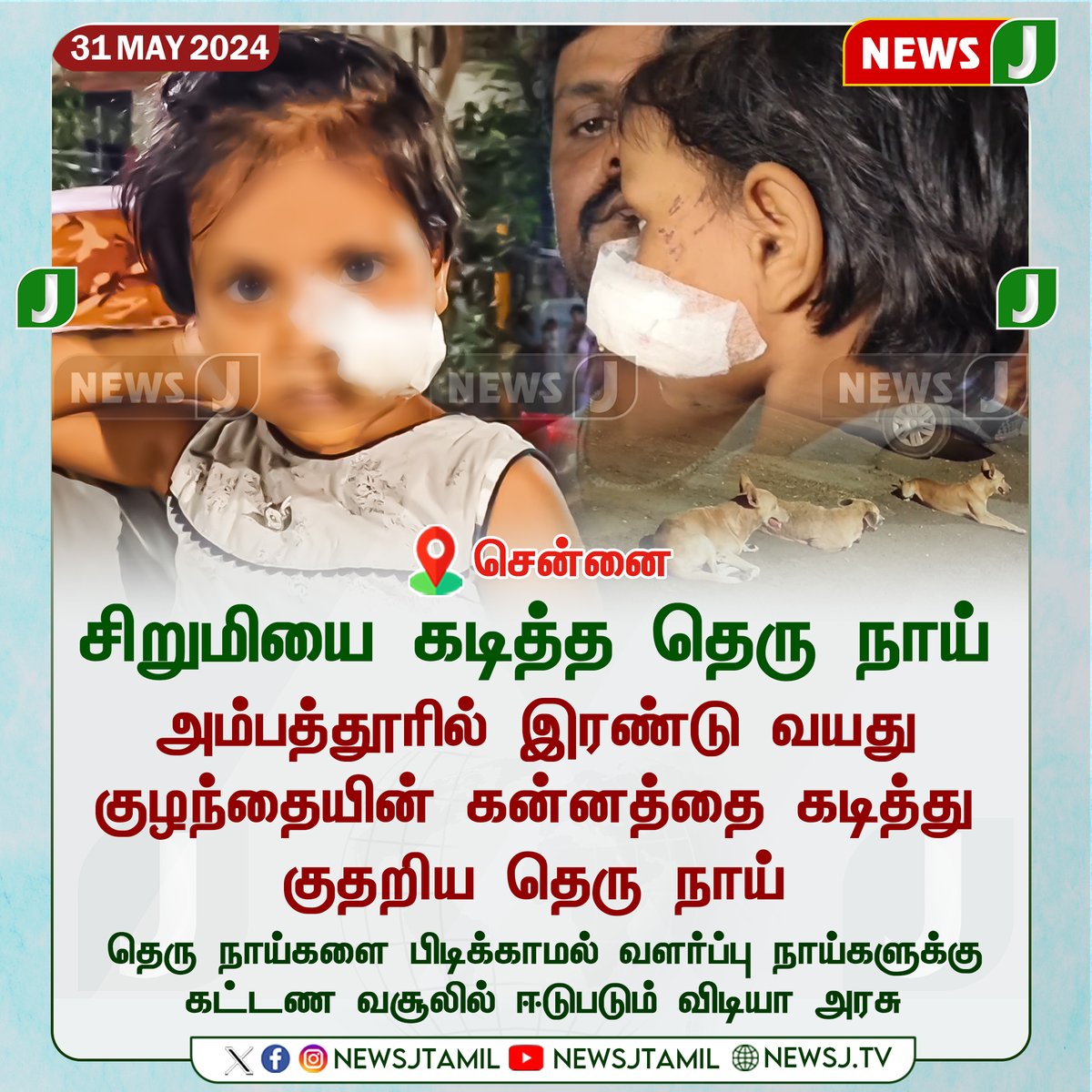 NewsJTamil's tweet image. சிறுமியை கடித்த தெரு நாய்...
#Dog #BitGirl #Chennai #newsj
