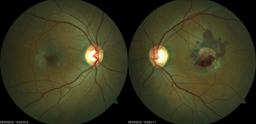 Residents do you know about a VIP in ophthalmology?

#MedTwitter #MedEd #ophthalmology
Image from google