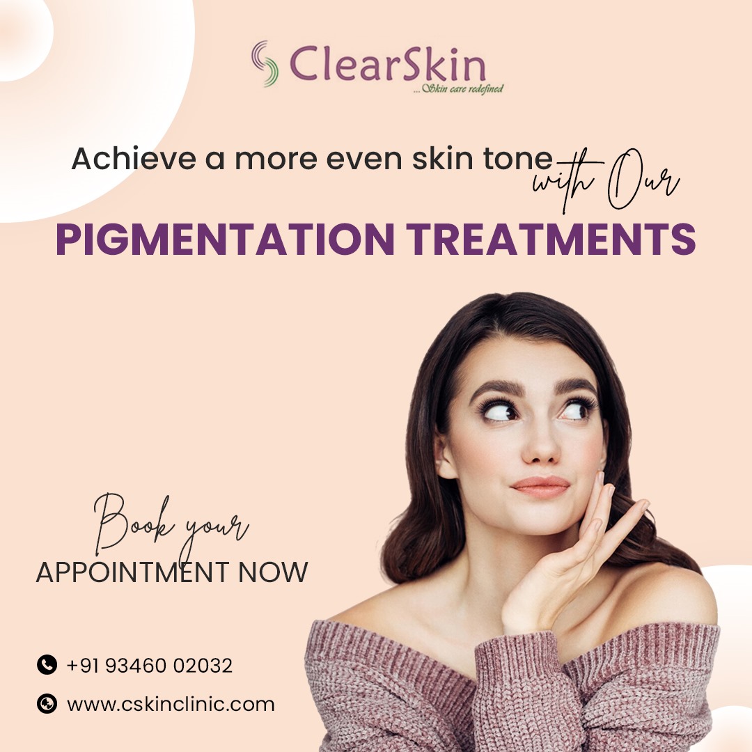 Struggling with uneven skin tone? Our pigmentation treatments can help! Say goodbye to dark spots and hello to a more radiant complexion. Book your appointment now
#clearskinclinic #dermatologist #pigmentation #pigmentationremoval #skintreatment #pigmentationtreatment