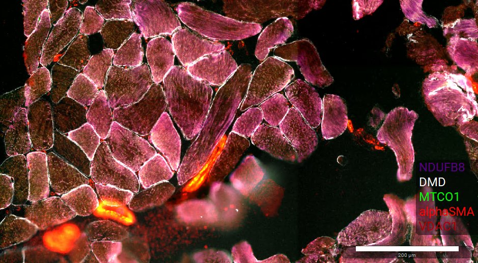 Valeria Di Leo (@valdileomito) on Twitter photo Very exciting to share some of my first few images of skeletal muscle using the new technology #MACSima from <a href="/miltenyibiotec/">Miltenyi Biotec</a>.
Looking forward to performing the big experiment on the cohort of patients đź’š
#mitochondrialresearchgroup <a href="/mitomusclelab/">Newcastle Mitochondria and muscle pathology</a> #newcastleuniversity <a href="/MDUK_News/">Muscular Dystrophy UK</a> Very exciting to share some of my first few images of skeletal muscle using the new technology #MACSima from <a href="/miltenyibiotec/">Miltenyi Biotec</a>.
Looking forward to performing the big experiment on the cohort of patients đź’š
#mitochondrialresearchgroup <a href="/mitomusclelab/">Newcastle Mitochondria and muscle pathology</a> #newcastleuniversity <a href="/MDUK_News/">Muscular Dystrophy UK</a>