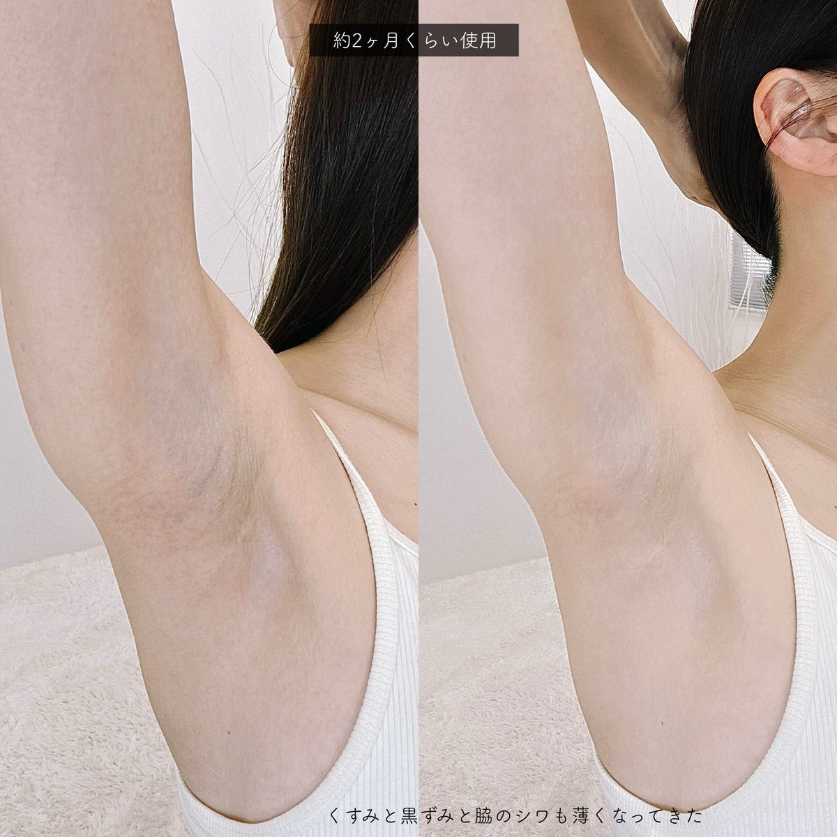 emiry_oinari's tweet image. 闇を纏いし漆黒のヴィランズ状態(美容外科考えてたほど)の脇とアソコがマッッッッッッッッッッじでザオリクした。12月のメガ割から使ってるから約半年くらいか？今回のメガ割でストック決定。美白＋高保湿＋全身の黒ずみこれ塗っときゃ解決。
#Qoo10メガ割