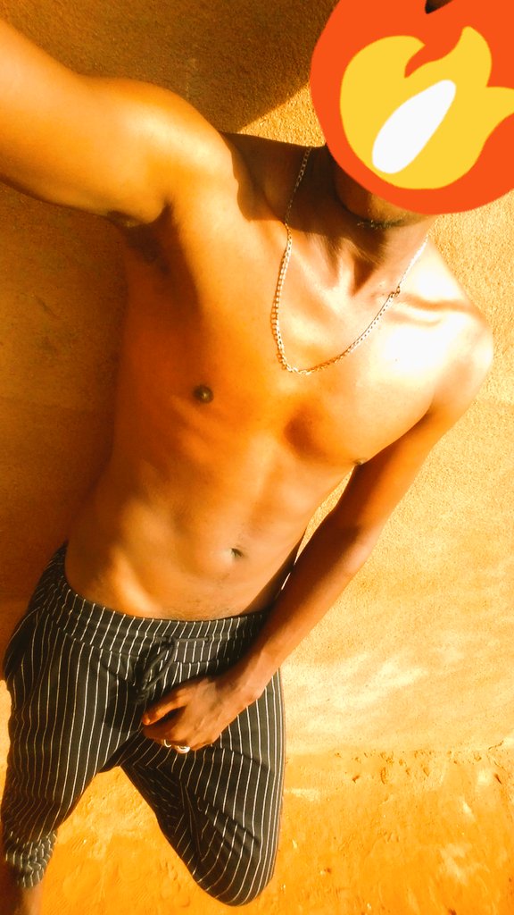 وضعي الطبيعي بقي عبارة عن صداع وفلس