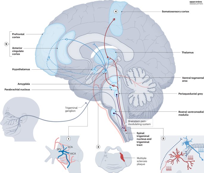 DiseasePrimers's tweet image. #Trigeminal primary afferents terminate on #neurons in the spinal trigeminal nucleus go.nature.com/4aEbVe9