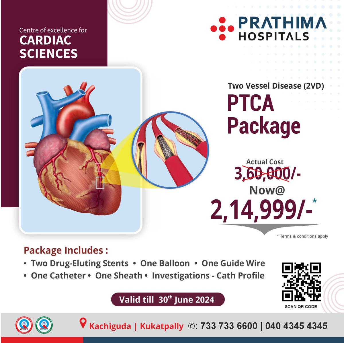 prathimahealth's tweet image. 𝐓𝐰𝐨 𝐕𝐞𝐬𝐬𝐞𝐥 𝐃𝐢𝐬𝐞𝐚𝐬𝐞 (2VD) (PTCA) 𝐏𝐚𝐜𝐤𝐚𝐠𝐞 @ 𝟐,𝟏𝟒,𝟗𝟗𝟗/-

𝐕𝐚𝐥𝐢𝐝 𝐭𝐢𝐥𝐥: 𝟑𝟎𝐭𝐡 𝐉𝐮𝐧𝐞 𝟐𝟎𝟐𝟒

#Cardicsciences #heartcheckup #Healthpackage #stent #Coronaryangioplasty #2vd #twovesseldisease #prathimahospitals #cardiocheckup #heartdoctor