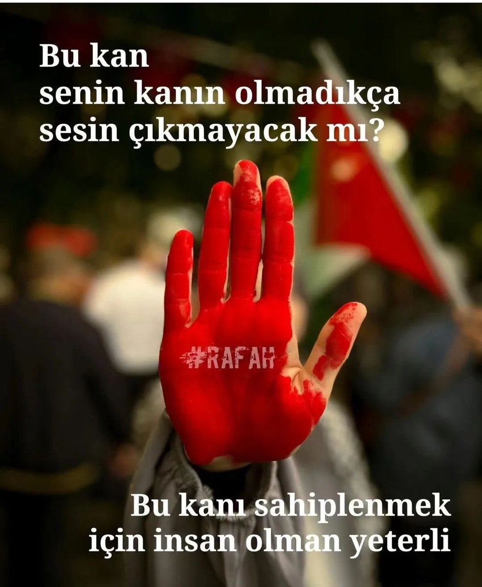 GAZZE Özgür değilse Dünya Tutsaktır...
Zalimler için yaşasın Cehennem...