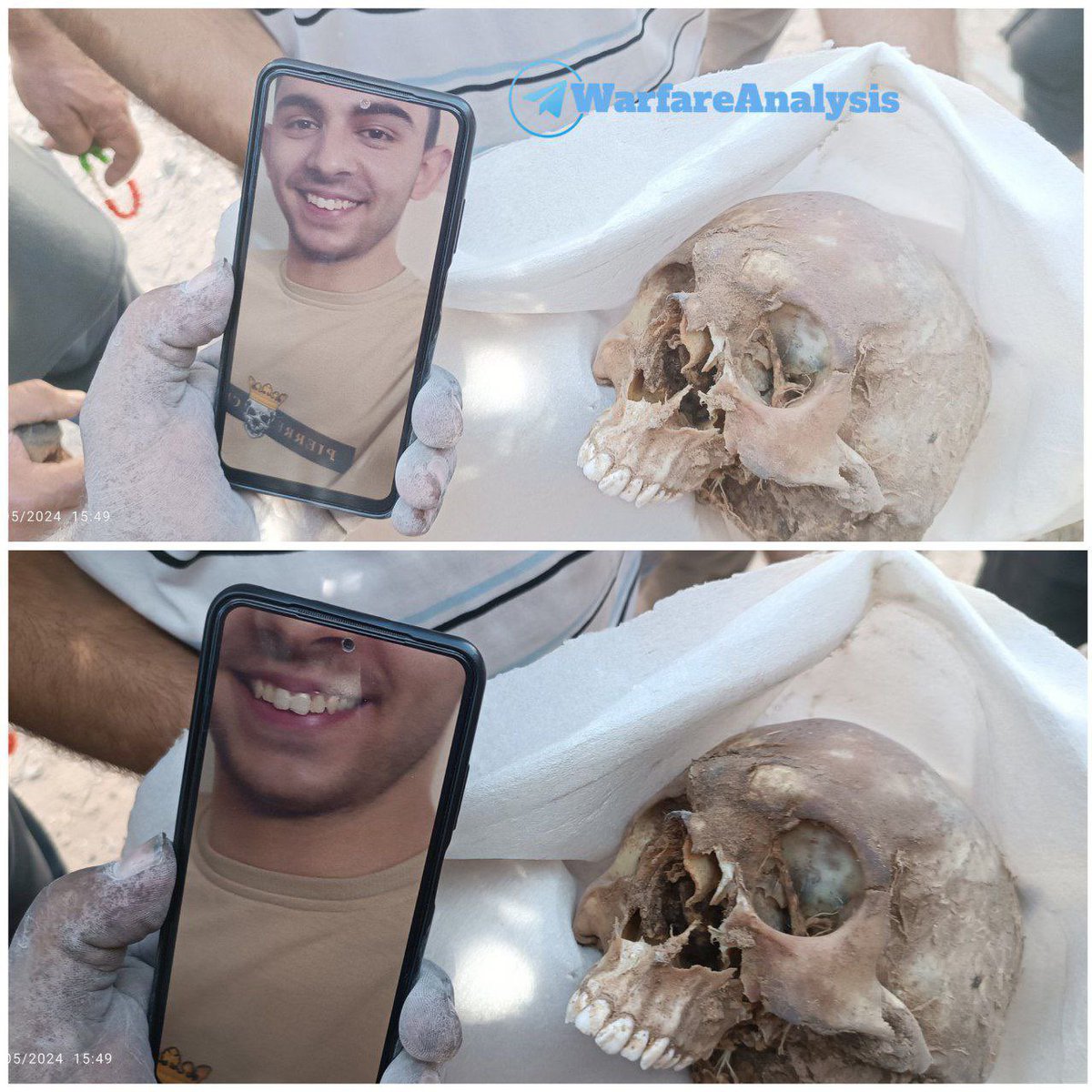 No words. The horror of having your find your child via a skull. From the shape of the teeth, the family was able to find the body of their son, the martyr Mahmoud Abd Rabbo, 19 years old, in Jabalia camp after the terrorist army withdrew from it.