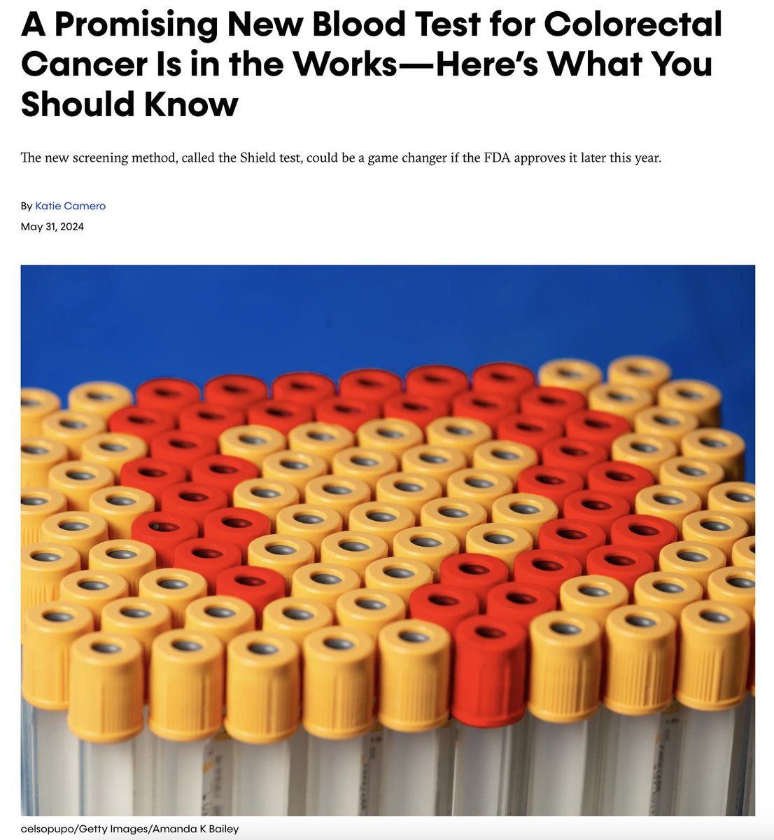 “#Coloncancer is the 2nd leading cause of #cancer death in US ... so any test that can make it easier for people ... is a big deal.” <a href="/DouglasCorley/">Douglas Corley</a> <a href="/kpnorcal/">KPNorthernCal</a> <a href="/PermanenteDocs/">PermanenteDoctors</a> tells <a href="/camerokt_/">Katie Camero</a> <a href="/SELFmagazine/">SELF</a> 

Story: ibit.ly/bcgAq