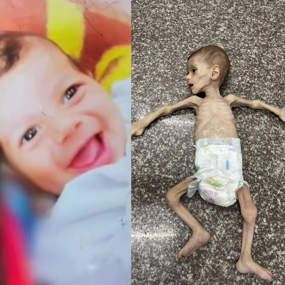 Faiz Abu Ataya was born during the war and survived 7 months of genocide before dying of starvation and lack of medical care. This is what Zionism does to Palestinian babies.