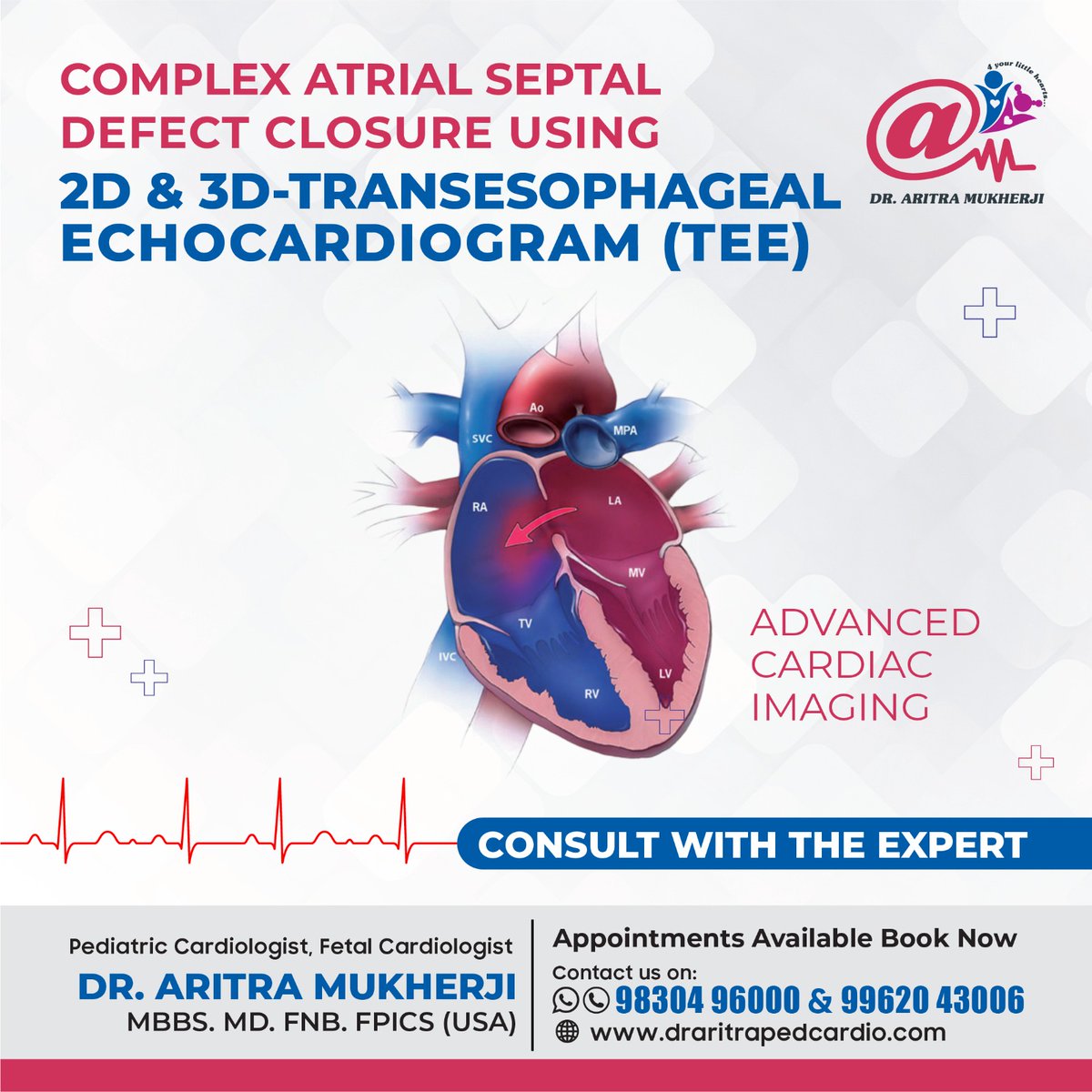 'Complex Atrial Septal Defect Closure' 
To know more, consult the specialist...
draritrapedcardio.com