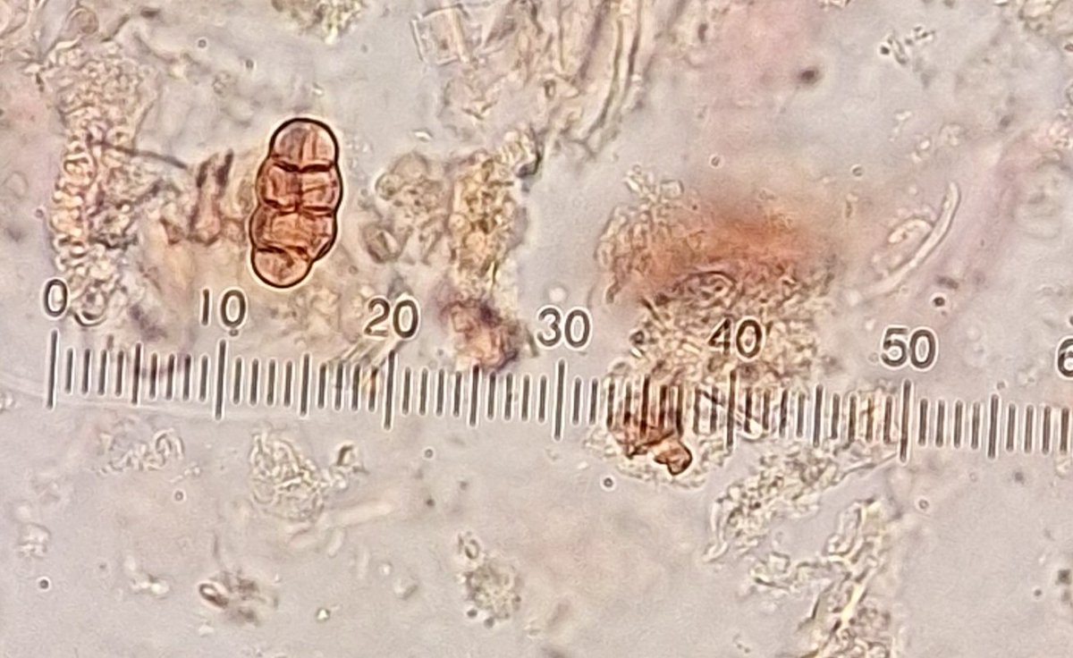 Dr Marta PerezFernandez tweet media