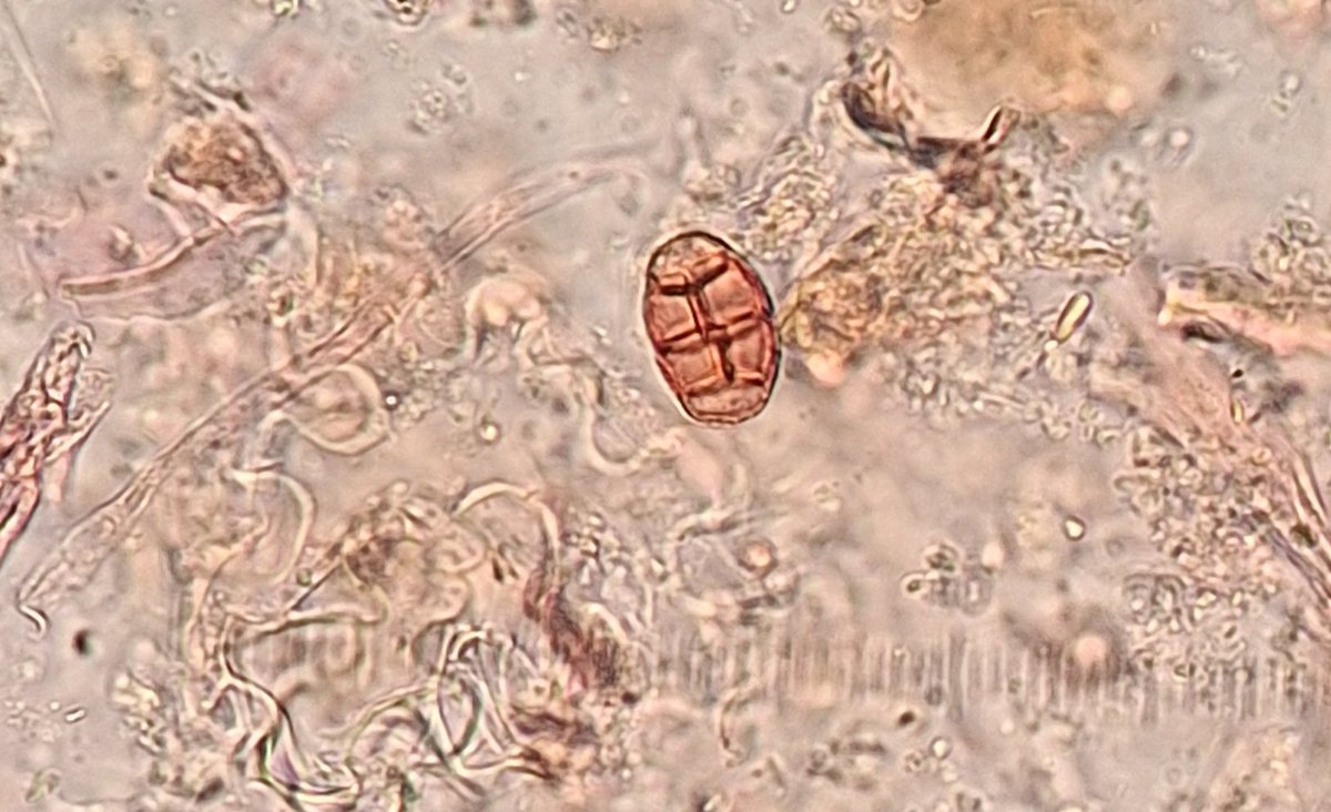 Dr Marta PerezFernandez (@martaperfer) on Twitter photo One of the Bison dung slides that I am analysing contains a number of Pithomyces spores. These are parasites found in grasses and cereals (Shumilowskikh etc al, 2021). They produce a mycotoxin toxic specially to sheep and cattle. This is the only time that I encountered them. One of the Bison dung slides that I am analysing contains a number of Pithomyces spores. These are parasites found in grasses and cereals (Shumilowskikh etc al, 2021). They produce a mycotoxin toxic specially to sheep and cattle. This is the only time that I encountered them.