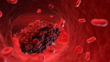 almayadeen_es's tweet photo. Encuentran microplásticos en coágulos de sangre, corazón y cerebro https://t.co/2GsqtVHLHw

#Salud #Sangre #Microplastico https://t.co/81ptuGxUvO