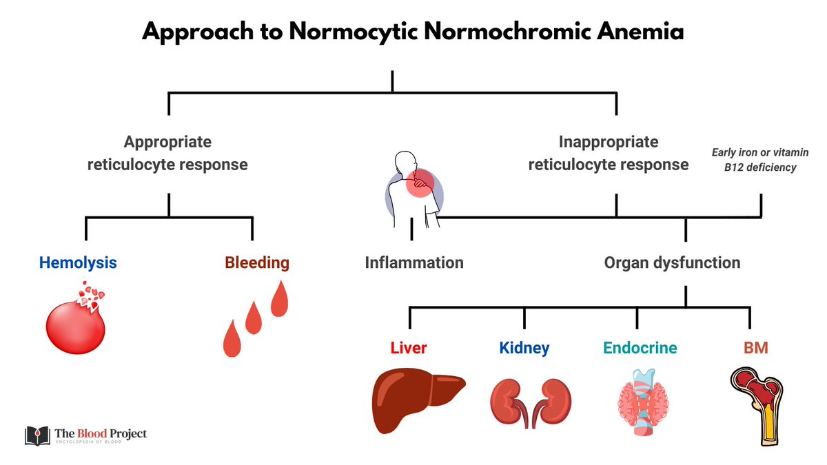 1/4

APPROACH TO NORMOCYTIC ANEMIA

This is the most common type of anemia, and its differential diagnosis can sometimes feel overwhelming, and 'all over the place'.

The following is organizational scheme with simple diagnostic buckets that covers virtually all causes: