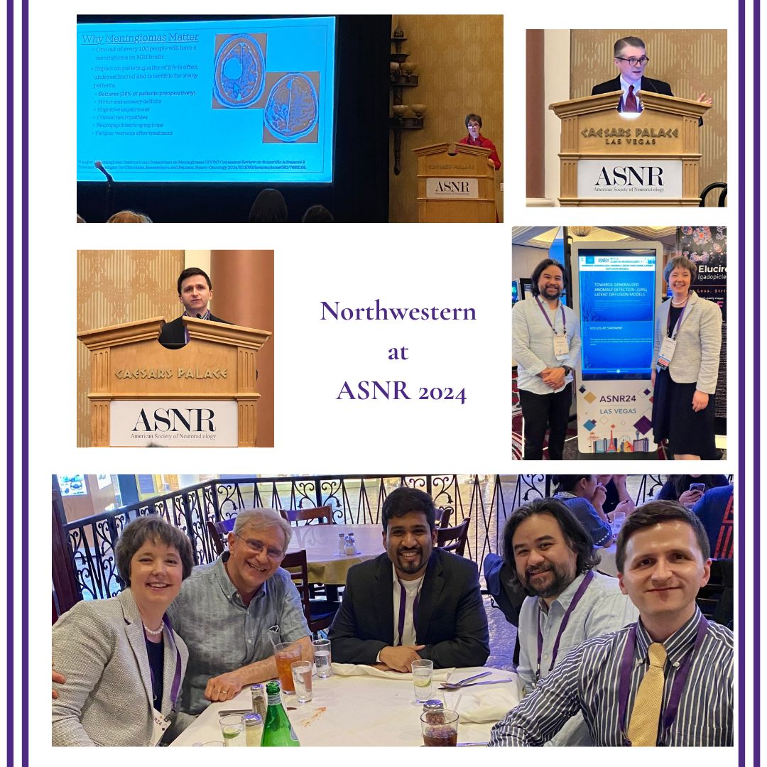 Northwestern Radiology (@nuradiology) on Twitter photo Great talks by <a href="/virginiabhill/">Virginia Hill, MD</a>, Dr. Alex Nemeth, <a href="/DavidLPayneMD/">David Payne, MD, MS</a>, and an electronic presentation by Nicholas Szrama at #ASNR24. One question attendees were left with: Should neurorads talk directly to patients? <a href="/TheASNR/">The American Society of Neuroradiology</a> #neuroradiology #imaging #radiology Great talks by <a href="/virginiabhill/">Virginia Hill, MD</a>, Dr. Alex Nemeth, <a href="/DavidLPayneMD/">David Payne, MD, MS</a>, and an electronic presentation by Nicholas Szrama at #ASNR24. One question attendees were left with: Should neurorads talk directly to patients? <a href="/TheASNR/">The American Society of Neuroradiology</a> #neuroradiology #imaging #radiology