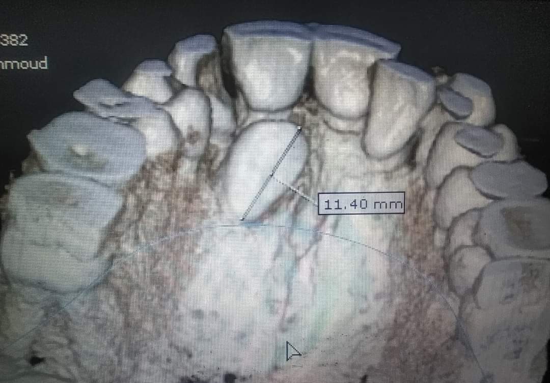 mostafa511997's tweet photo. Cbct https://t.co/aOpYheWbSp
