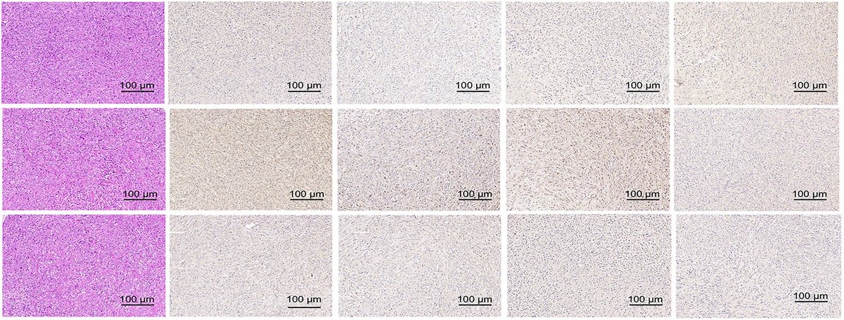 Scientists showed that circ_0001671 exerts an oncogenic effect in #ProstateCancer through the regulation of bloom syndrome protein by sponging 🌕 miR-27b-3p. 🔗 go.nature.com/4bVoPp8