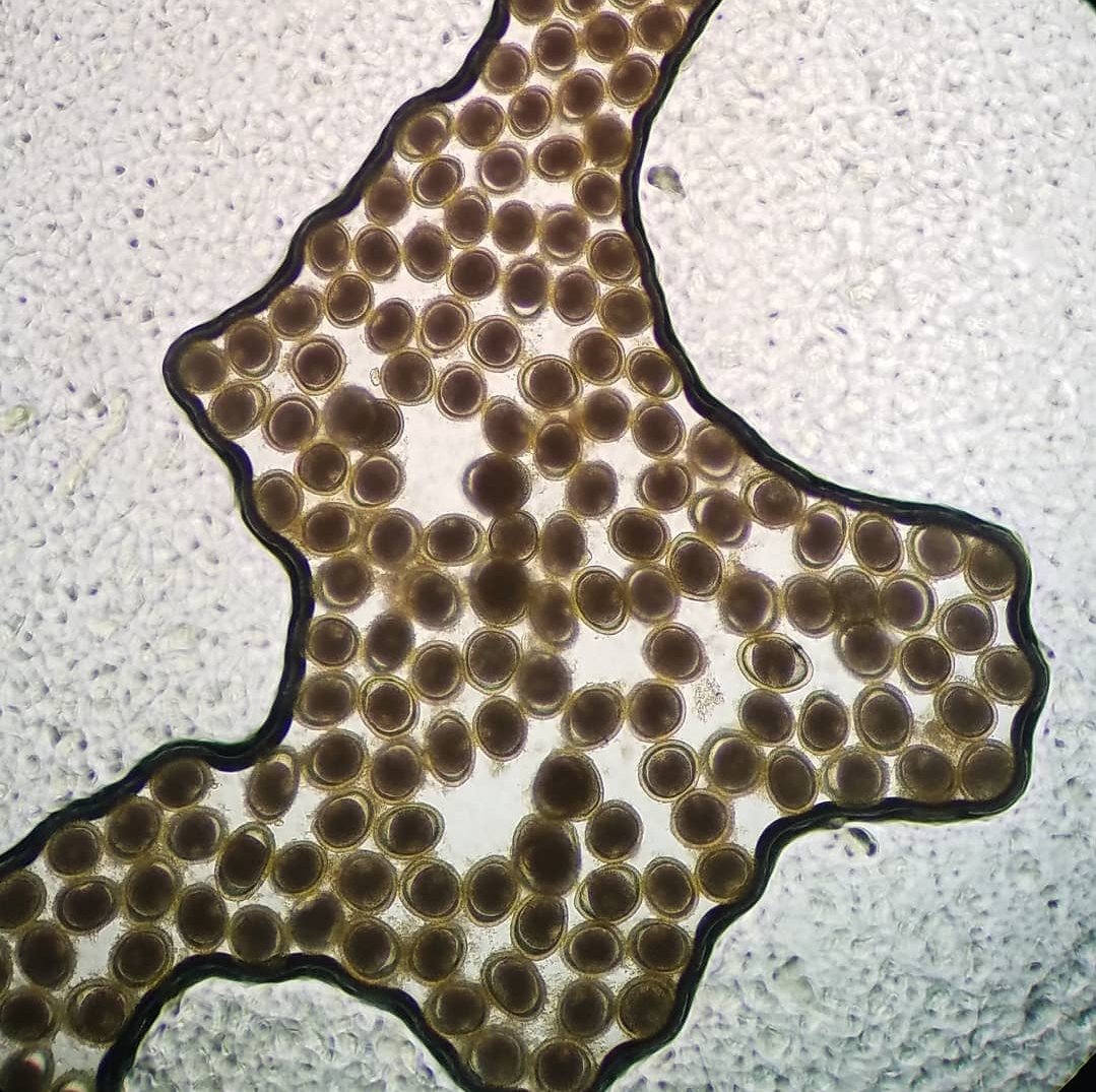 Vet_Parasites's tweet photo. I left this slide sitting out overnight. The zinc sulfate float solution crystallized around the Toxocara canis ova #vetlab #veterinarymedicine #veterinaria #parasitology #parasites #veterinary #vet #worms #vetstudent #veterinarytechnician #vetnurse #vetlife #parasitologia #dvm https://t.co/sGAbMMCNAF