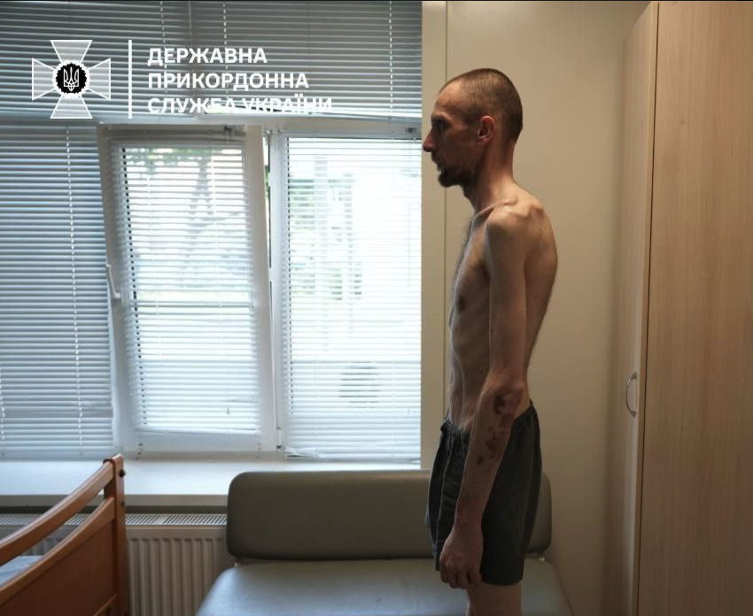 uanews3's tweet photo. Це українець, якого повернули сьогодні з полону. https://t.co/KyxUXu0pzp