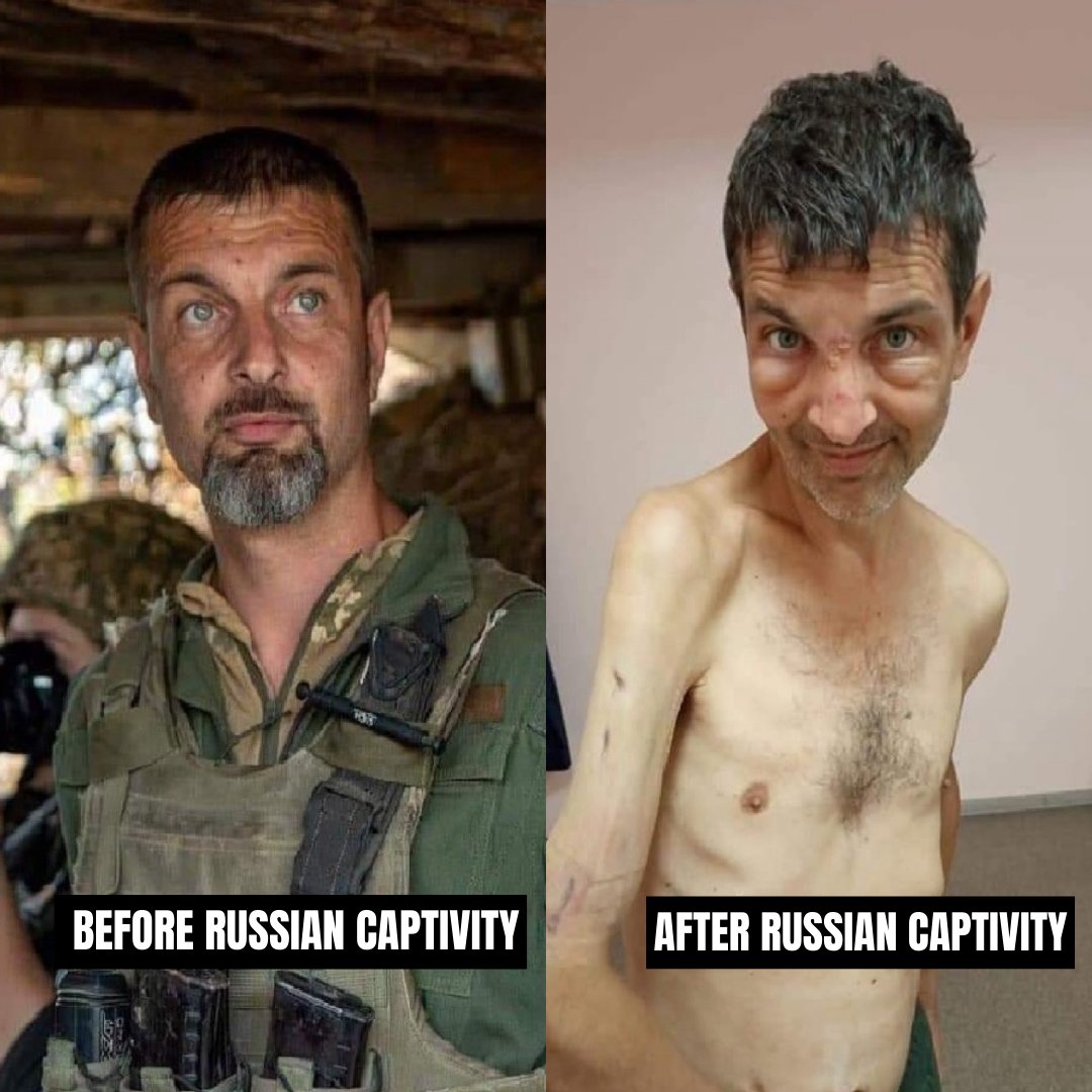 Russians are persistently mistreating and torturing Ukrainian POWs.

While we celebrate the return of 75 POWs from captivity, many remain in prisons, enduring immense suffering.

Let's not forget the prisoners of war who Russia continues to starve and brutalize daily.