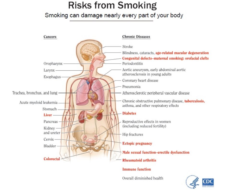 Did you know that smoking not only affects your lung health but can also affect your oral health as well? Smoking can cause taste disorders, gum disease, and in more severe cases mouth cancer.   #WorldNoTobaccoDay