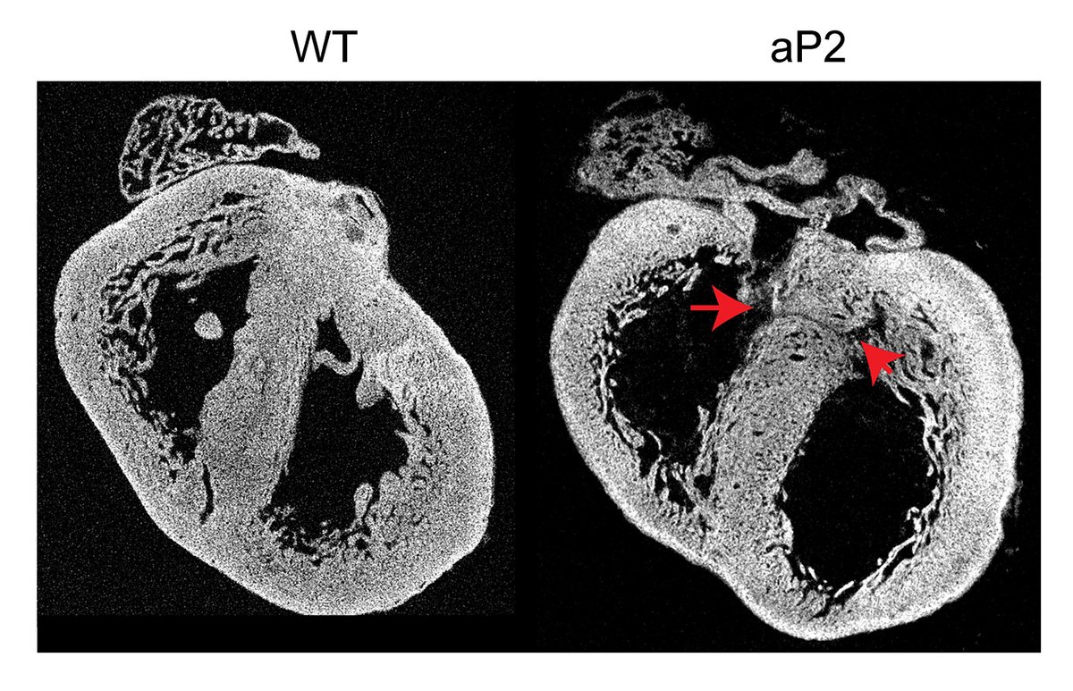 Circulation Research (@circres) on Twitter photo Sultan et al found that post-translational regulation of #VEGF-B isoforms differs in #cardiomyocytes versus cardiac #endothelial cells. Learn more at ahajrnls.org/3R37bYr
@kivela_lab <a href="/pipsa_saharinen/">Pipsa Saharinen</a> <a href="/MarkusOttoHjalm/">Markus Ramste</a> <a href="/KarthikAmudhala/">Karthik A. Hemanthakumar</a> <a href="/salliantila/">Salli Antila</a> Sultan et al found that post-translational regulation of #VEGF-B isoforms differs in #cardiomyocytes versus cardiac #endothelial cells. Learn more at ahajrnls.org/3R37bYr
@kivela_lab <a href="/pipsa_saharinen/">Pipsa Saharinen</a> <a href="/MarkusOttoHjalm/">Markus Ramste</a> <a href="/KarthikAmudhala/">Karthik A. Hemanthakumar</a> <a href="/salliantila/">Salli Antila</a>