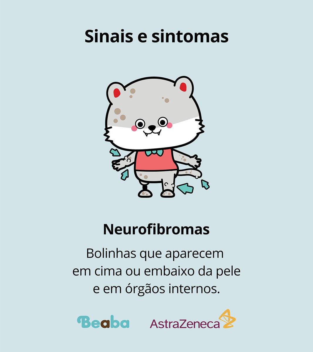 beabaorg's tweet image. Maio é o Mês da Neurofibromatose, uma condição genética que afeta milhões de pessoas no mundo todo. Quanto antes diagnosticada, melhor para ser tratada.

Aqui vão algumas informações sobre a neurofibromatose tipo 1. Você pode ajudar aprendendo e compartilhando informações.