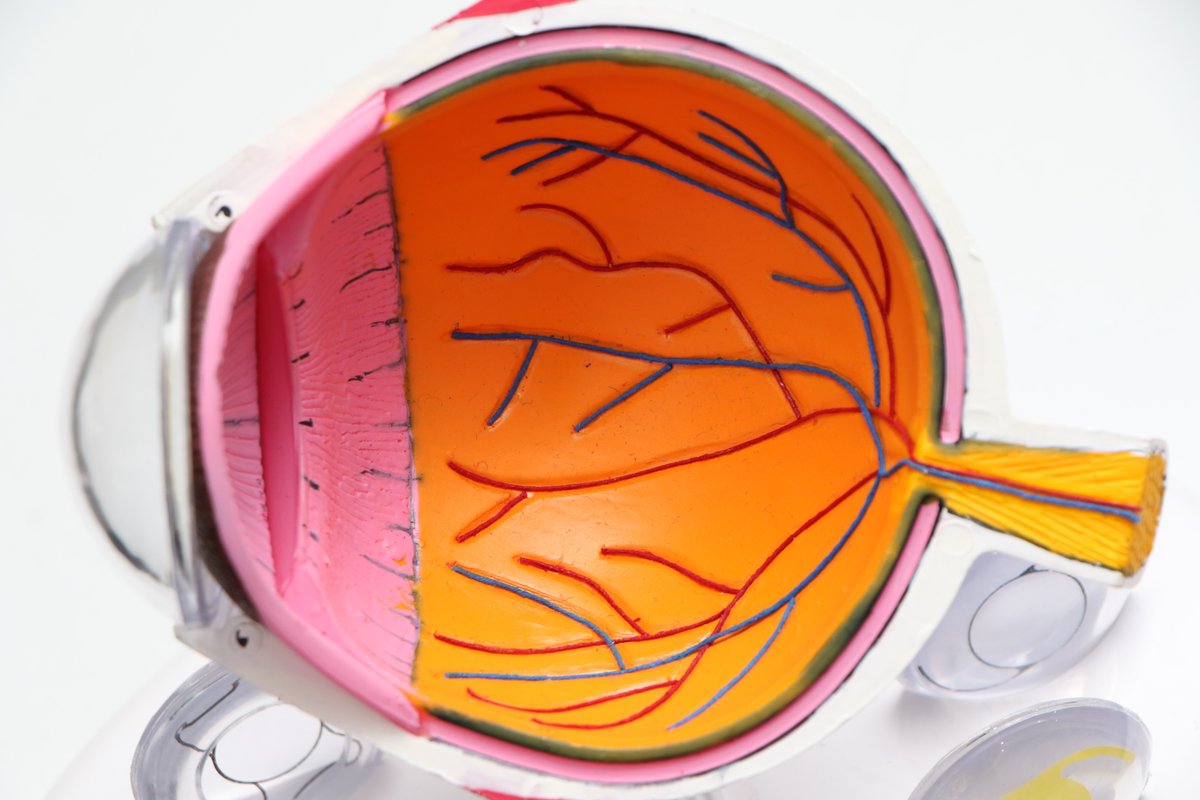 Does #aspirin help or worsen age-related macular degeneration? jwat.ch/3V4LRDf