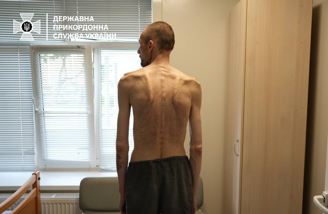 A Ukrainian soldier after Russian captivity. Now compare this with what Russian POWs look like as they get back home from Ukraine. This is insane.