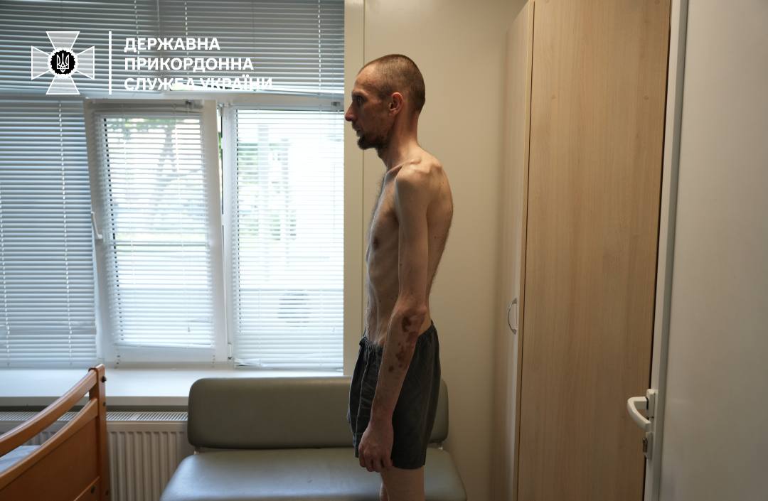 IAPonomarenko's tweet photo. A Ukrainian soldier after Russian captivity.

Now compare this with what Russian POWs look like as they get back home from Ukraine.

This is insane. https://t.co/E9NtY6kjjx