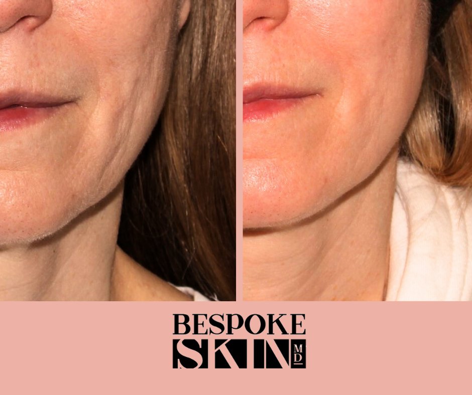 Bespoke Skin MD tweet media