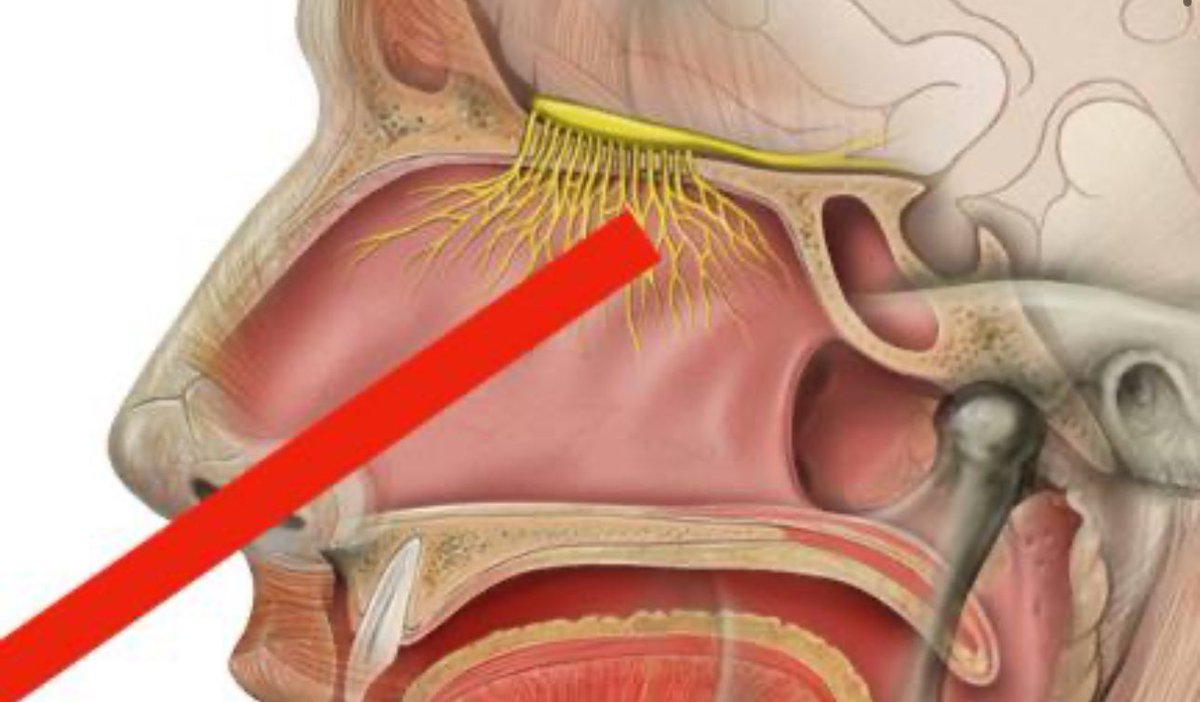 DJELLE_'s tweet image. @LiliRose135

   #PCR #TESTPCR

Ton  article date de 2022!!! 

TEST PCR NASOPHARYNGÉ POUR LA COVID 

Le CDC (Centres pour le contrôle et la prévention des maladies)  a annoncé en juillet 2021 qu’il RETIRE sa demande d’autorisation d’utilisation en urgence (EUA) pour son test PCR