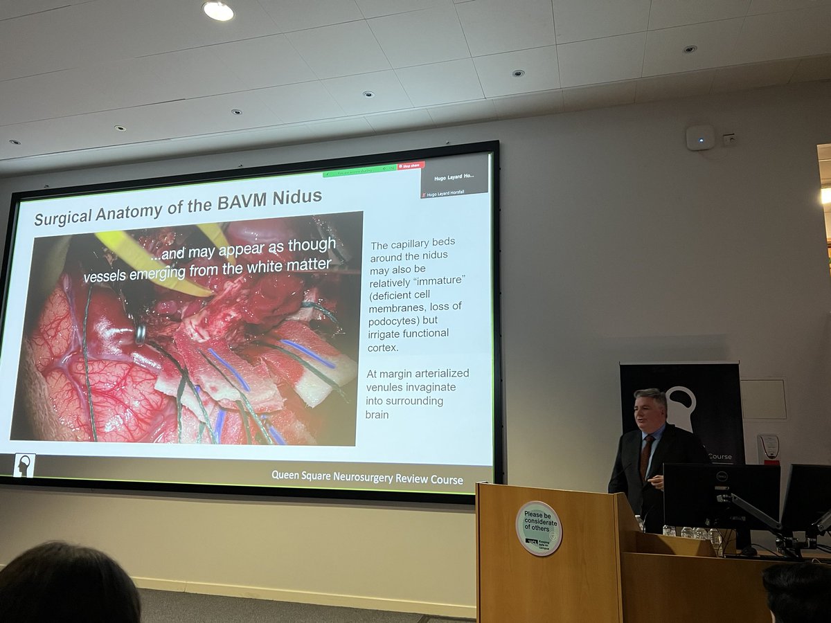 Queen Square Neurosurgery Review Course (@qsreview) on Twitter photo Consultant neurosurgeon <a href="/DanielWalshFRCS/">Daniel Walsh FRCS</a> delivering his talk on cerebral AVMs and dural fistulas Consultant neurosurgeon <a href="/DanielWalshFRCS/">Daniel Walsh FRCS</a> delivering his talk on cerebral AVMs and dural fistulas