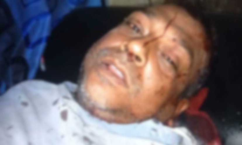 বাগাতিপাড়ায় মধ্যরাতে চেয়ারম্যান প্রার্থীর সমর্থকের মাথা ফাটাল কারা?