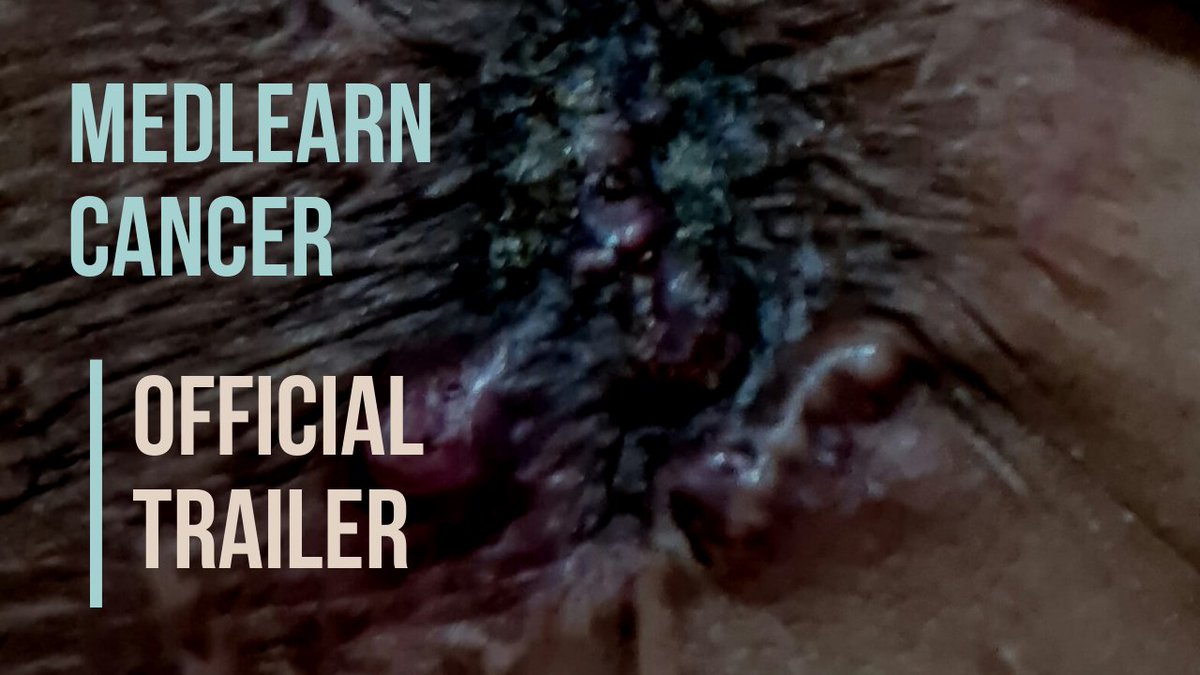 🎬 Explore the MedLearn Cancer video series for expert insights. NHS professionals and industry suppliers, contribute your knowledge to drive innovation. Contact us to get involved. #MedLearn #CancerResearch #HealthTech #NHS VIEW: youtu.be/88tirs_S85I?si…