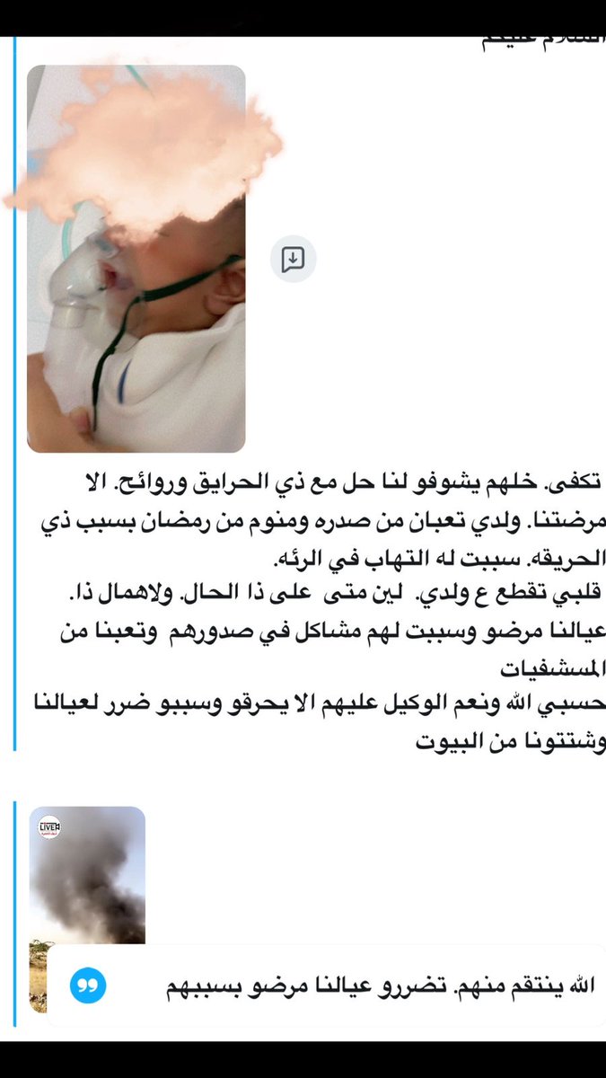 alaao_94's tweet photo. #حرائق_جنوب_جده_الخمره
اش ذنب الأطفال واش ذنب كبار السن واش ذنب الساكنين في الحي هل يعقل لايوجد اي جهه تشعر بمعاناة السكان سواءً من ريحة الحرائق او من روائح الصرف الصحي اصبح هم لكل الساكنين، حسبنا الله ونعم الوكيل…
@JeddahAmanah @JeddahNow @jedgovsa @Jeddahhealth https://t.co/h9yRbTHyGa
