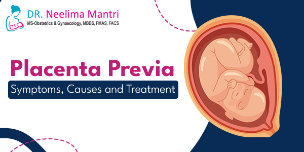 Placenta Previa: Symptoms, Causes and Treatment Placenta previa is a condition where the baby’s exit path from the womb is blocked by the abnormal positioning of the placenta... Know more at: drneelimamantri.com/blog/placenta-… #PlacentaPrevia #TreatmentForPlacentaPrevia #Gynaecologist