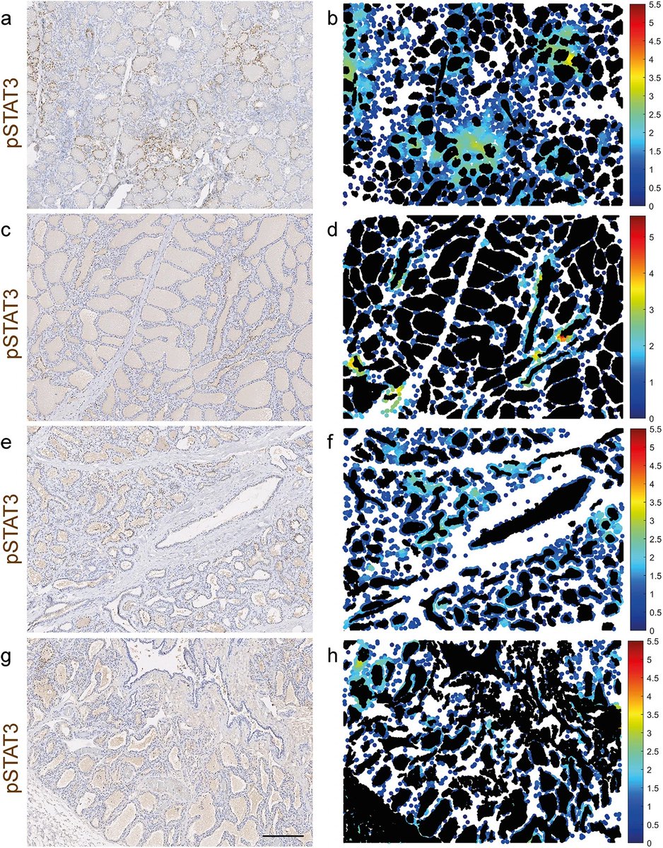 📢New insights into mammary sub-microenvironments! Colocation analysis by @katevetpath team uncovers the multifocal clustering of P-STAT3 in the #mammary glands of 🐭 & 🐄 around birth. Macrophages also show distinct clustering.🔬 #MethodsAndModels shorturl.at/YSwKp