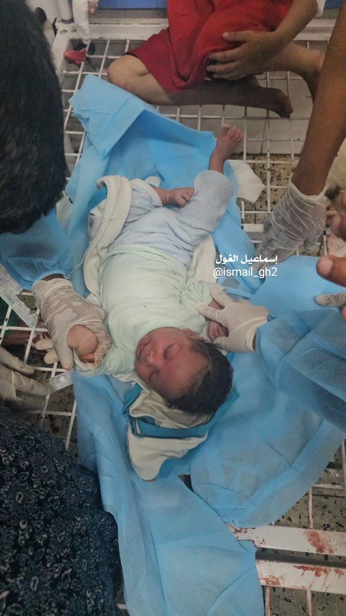 طفل أصيب في الغارات الإسرائيلية على حي الشيخ رضوان الليلة 
هذه أهداف الاحتلال