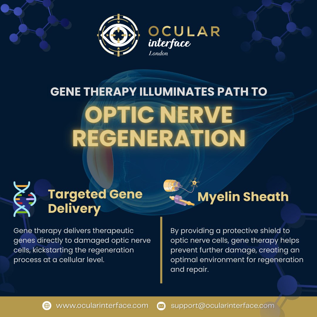 Gene Therapy Illuminates Path to Optic Nerve Regeneration 🔬

Discover more about the future of vision restoration.
🔗 ocularinterface.com

#GeneTherapy #OpticNerveRegeneration #VisionRestoration #OcularInterface #MedicalInnovation #EyeHealth #RegenerativeMedicine