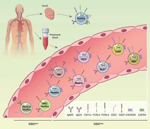 Memory #Bcells that lack or express low levels of CD21 increase with older age & in chronic #inflammatory conditions Here, Gjertsson et al. discuss CD21–/low #Bcell in different conditions, looking for similarities in gene signatures & functions ➡️bit.ly/3m6yYuT