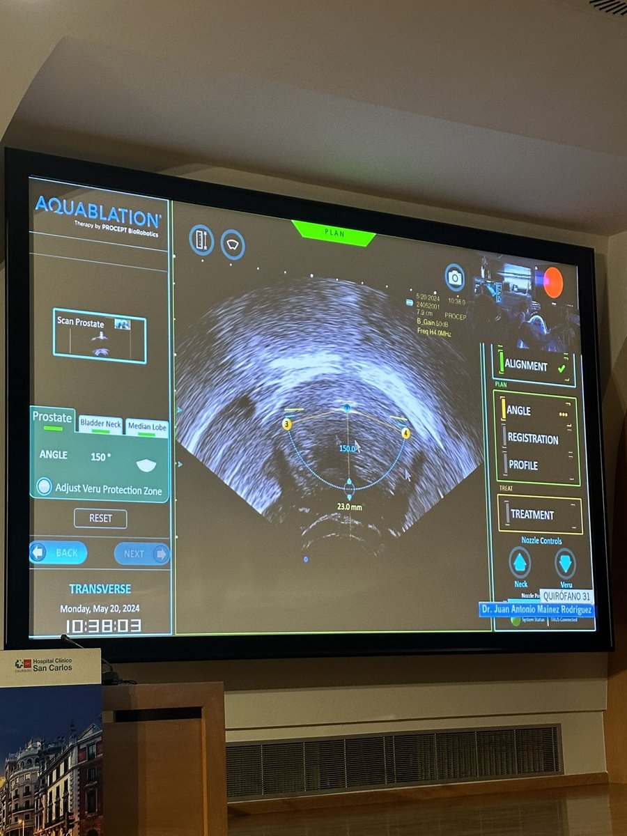 AQUABEAM

#somosclinico #6cursoCUM

<a href="/JesusMorenosier/">Doctor J Moreno Sierra</a>