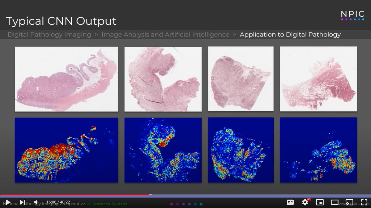 NPIC_AI's tweet photo. If you missed the @NPICDigital webinar on #AI in #digitalpathology, you can watch the presentations here: https://t.co/l7aG9uKLRV https://t.co/9xwGVG3qoK