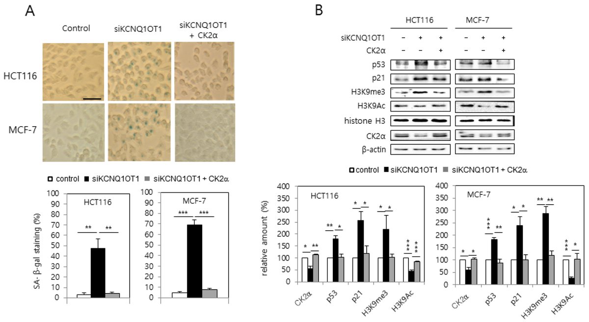 🌟#notablepaper on #ProteinKinaseInhibitor 📚Long Non-Coding RNA #KCNQ1OT1 Regulates Protein Kinase CK2 Via miR-760 in #Senescence and #CalorieRestriction 🔗mdpi.com/1488332 👨‍🔬By Prof. Young-Seuk Bae et al @MDPIOpenAccess @MDPIBiologySubj #inhibitor #longnoncodingRNA