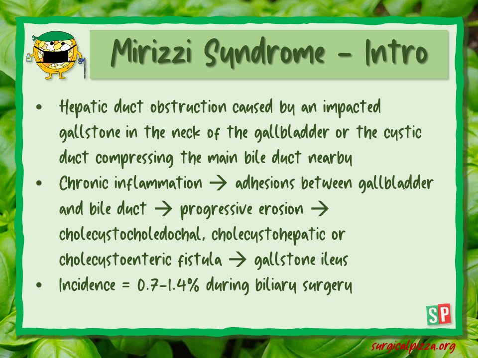surgicalpizza's tweet photo. What is the #Mirizzi syndrome... One of the many nightmares of #gallbladder surgery...
To learn more: https://t.co/dBHUKV5IaK
#spbites 🍕 #surgicalpizza #surgery #ACS #emergencysurgery #education #cholecystectomy #gallbladderremoval #MedTwitter #meded https://t.co/152vFmsHKj